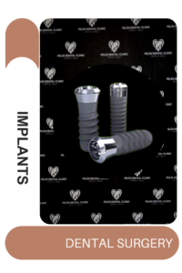 DENTAL IMPLANTS